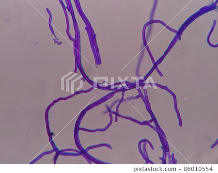 Hyphae dyed in stain solution 86010554