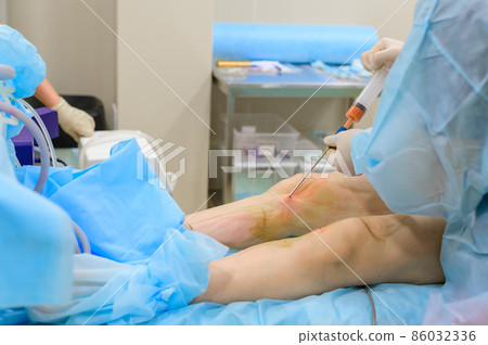 Cosmetic surgery liposuction. The process of removing fat on the legs of a fat woman. Without face, unrecognizable patient. 86032336