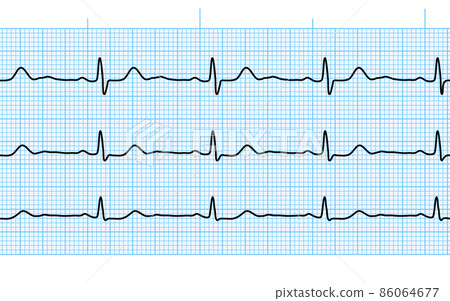 Heart beat ecg or ekg seamless black line on blue paper Heart beat ecg or ekg seamless black line on blue paper 86064677