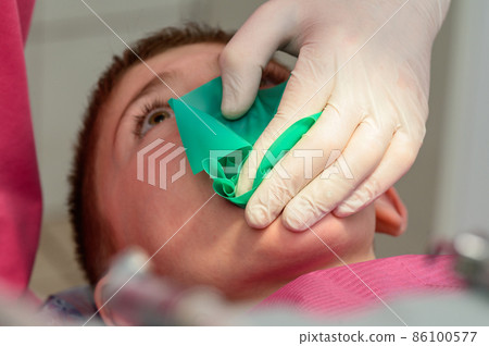 The dentist installs a rubber dam and a clamp for the treatment of a diseased tooth. The dentist installs a rubber dam and a clamp for the treatment of a diseased tooth. 86100577