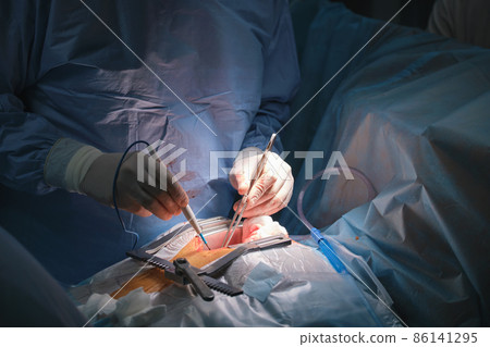Closeup of doctors hands operating a patient conducting open cut surgery in surgical room. Healthcare and medical intervention concept Closeup of doctors hands operating a patient conducting open cut surgery in surgical room. Healthcare and medical intervention concept 86141295