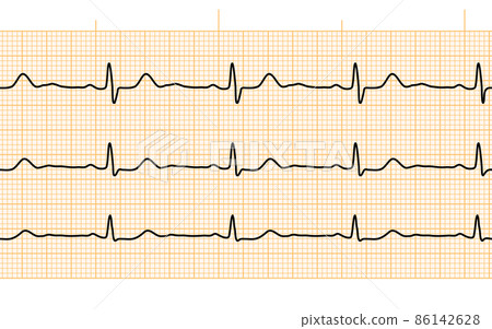 Heart beat ecg or ekg seamless black line on orange paper Heart beat ecg or ekg seamless black line on orange paper 86142628