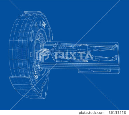 MRI machine scanning patient inside 86155258