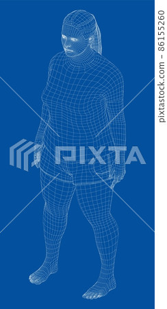 Fat woman, before weight loss 86155260