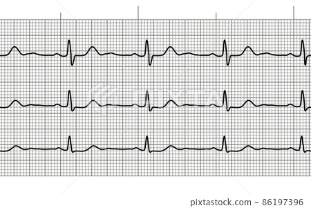 Heart beat ecg or ekg seamless line on black and white paper 86197396