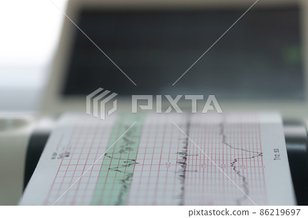 Electronic Cardiotocography Machine Monitoring Fetal Heart Contractions Of Uterus. Printing Cardiogram Report Coming Out Electrocardiogram In Labor Ward During Pregnancy. Medical Diagnostic Equipment Electronic Cardiotocography Machine Monitoring Fetal Heart Contractions Of Uterus. Printing Cardiogram Report Coming Out Electrocardiogram In Labor Ward During Pregnancy. Medical Diagnostic Equipment 86219697