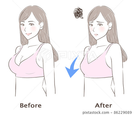 胸圍下降的女性 86229089