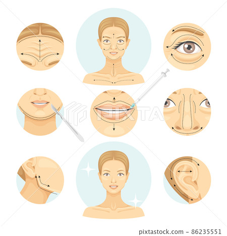 Plastic surgery set. Blepharoplasty, otoplasty, rhinoplasty, contouring lift vector illustration Plastic surgery set. Blepharoplasty, otoplasty, rhinoplasty, contouring lift vector illustration 86235551