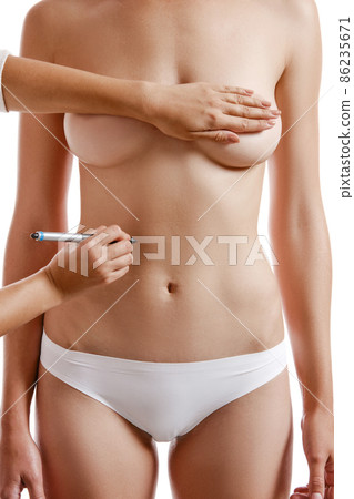 Perfect body of girl in white underwear, isolated on white. Doctor hands drawing scheme on female belly before operation. Plastic surgery. Close-up. 86235671
