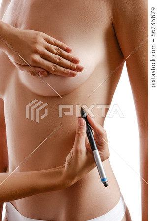 Young body of girl posing isolated on white. Doctor hands drawing scheme with marker on female breast before operation. Plastic surgery. Close-up. Young body of girl posing isolated on white. Doctor hands drawing scheme with marker on female breast before operation. Plastic surgery. Close-up. 86235679