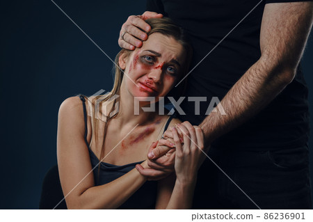 Man put his hand on female head, like hugging. They holding hands. Victim with bruises sitting nearby. Blue background. Domestic violence. Close-up. Man put his hand on female head, like hugging. They holding hands. Victim with bruises sitting nearby. Blue background. Domestic violence. Close-up. 86236901