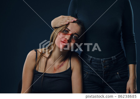Female in black blouse has put her hand on head of a girl. Victim with bruises on face sitting nearby. Blue background. Domestic violence. Close-up. Female in black blouse has put her hand on head of a girl. Victim with bruises on face sitting nearby. Blue background. Domestic violence. Close-up. 86238685
