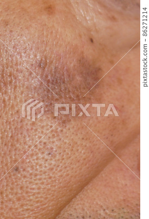 老人臉頰上有大塊污漬 5 86271214