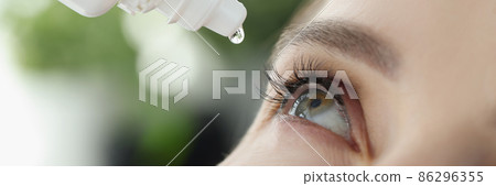 Woman drips eye drops into eye for allergies closeup Woman drips eye drops into eye for allergies closeup 86296355