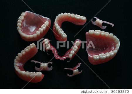 Dentures on a black background. Close-up of dentures. Dentistry is conceptual photography. Prosthetic dentistry. False teeth. Prosthetics. Close-up of plastic dentures. Teeth on a black background Dentures on a black background. Close-up of dentures. Dentistry is conceptual photography. Prosthetic dentistry. False teeth. Prosthetics. Close-up of plastic dentures. Teeth on a black background 86363270