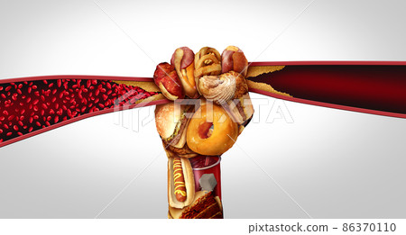 Artery Disease And Food Artery Disease And Food 86370110