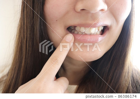 Female during orthodontics 86386174