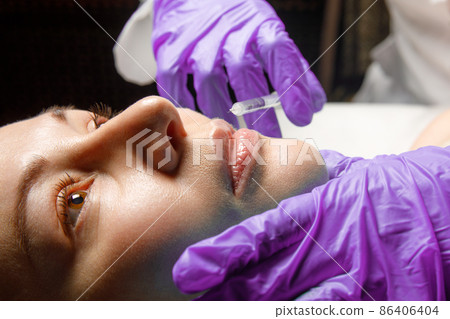 Lip shape correction procedure in a cosmetology salon. The specialist makes an injection on the lips of the patient. Lip augmentation. 86406404