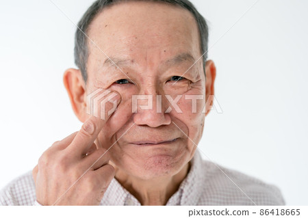 老年男性眼睛白內障乾眼症 86418665