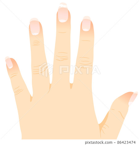 Finger with broken nails Finger with broken nails 86423474
