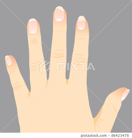 Fingers with onycholysis Fingers with onycholysis 86423478