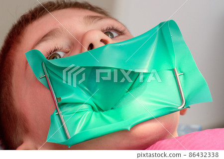 The dentist treats the child's tooth using a rubber dam. The dentist treats the child's tooth using a rubber dam. 86432338