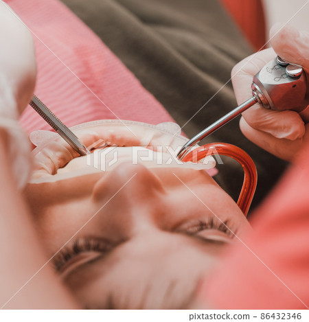 Dental treatment of a child, removal of caries with a drill, open mouth and ejector saliva. Dental treatment of a child, removal of caries with a drill, open mouth and ejector saliva. 86432346
