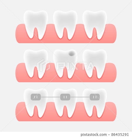 Dental care concept. Credit card icon. Vector design. Medical insurance card icon Dental care concept. Credit card icon. Vector design. Medical insurance card icon 86435291