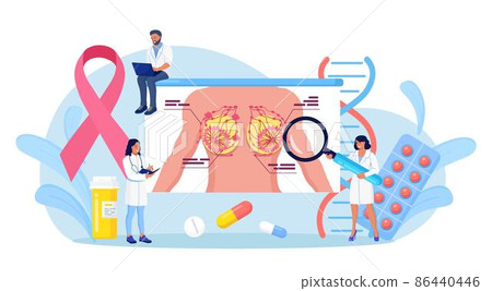 Breast cancer. Tiny doctors mammologist examine woman patient with magnifier to treat cancer. Breast ultrasound and mammography, diagnostic of oncology. Examination in the clinic, medical diagnosis 86440446