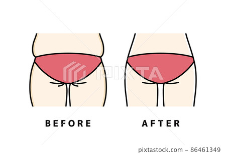 飲食臀部 飲食臀部 86461349