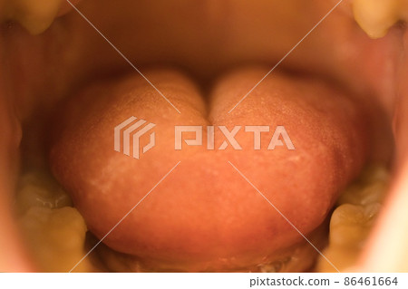 In the mouth 86461664