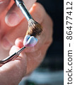 Dental Prosthesis 86477412