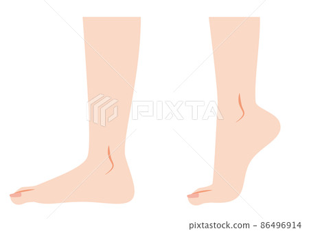 Standing on tiptoe, raising heels 86496914