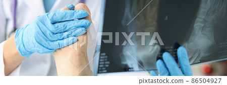 Doctor looking at xray of foot and examining patient leg closeup 86504927