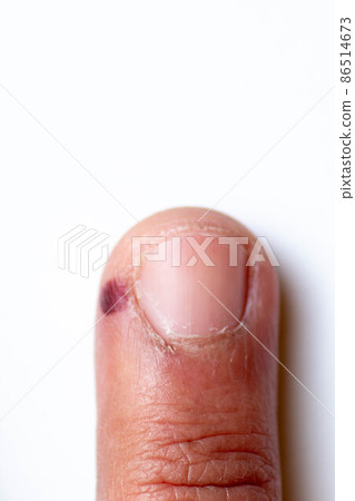Toes, hands, finger, and nails. Male human body parts 30 to 40 years old Toes, hands, finger, and nails. Male human body parts 30 to 40 years old 86514673