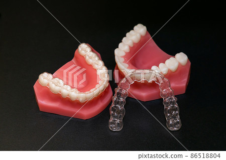Dental mouthpiece orthodontic image 86518804