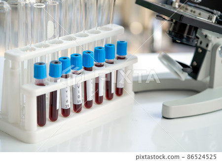 Blood collection tubes from covid 19 patients place next to microscope on white laboratory table. Coronavirus disease 2019 testing process in a laboratory preventing the spread of viral research. Blood collection tubes from covid 19 patients place next to microscope on white laboratory table. Coronavirus disease 2019 testing process in a laboratory preventing the spread of viral research. 86524525