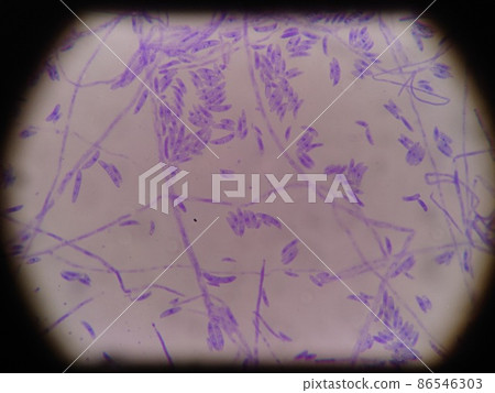 Spore staining of Fungi imperfecti Fusarium 86546303
