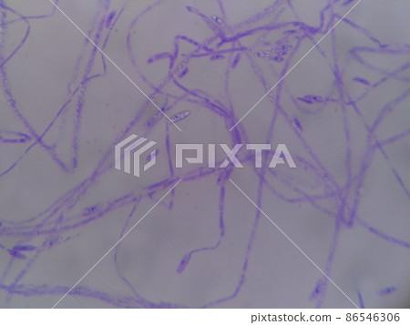 Staining of poorly dyed spores Staining of poorly dyed spores 86546306