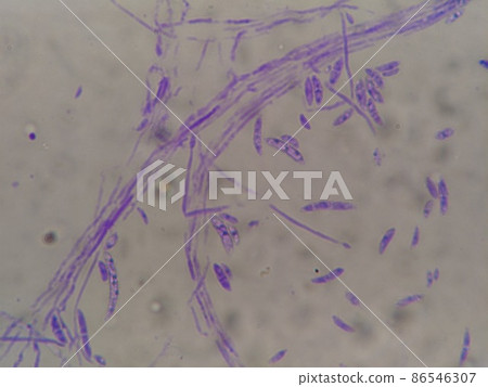 Fusarium inhabiting the soil 86546307