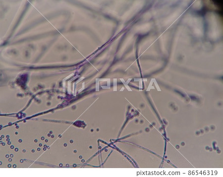 Moldy hyphae spreading in space 86546319