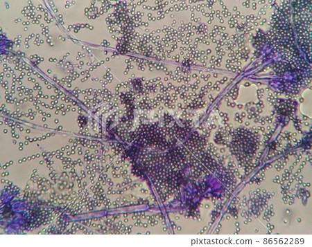 Penicillium with a large amount of spores 86562289