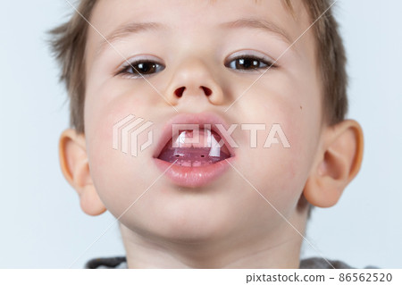 Cute little caucasian boy shows myofunctional trainer. Cute little caucasian boy shows myofunctional trainer. 86562520