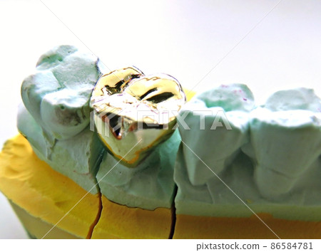 Dental gold crown 86584781