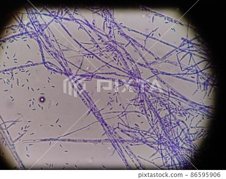 粉紅色黴菌菌絲 86595906