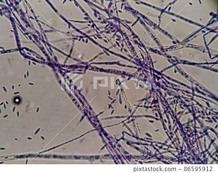 粉紅色黴菌孢子和菌絲 86595912