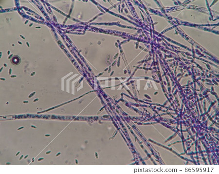 孢子形孢子 孢子形孢子 86595917