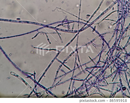 Where the hyphae of the genus Penicillium are growing Where the hyphae of the genus Penicillium are growing 86595918