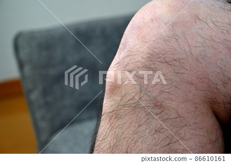 Osgood's disease Osgood-Schlatter's disease Growing pains knees and feet Osgood's disease Osgood-Schlatter's disease Growing pains knees and feet 86610161