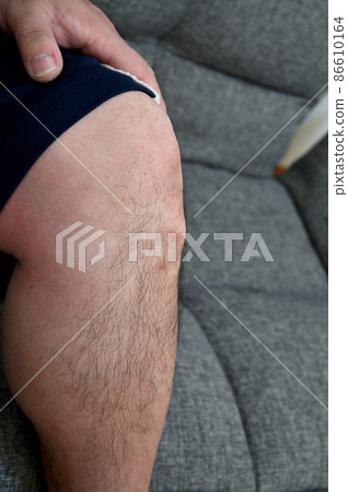 奧斯古德病 Osgood-Schlatter 病 膝蓋和腳的生長痛 奧斯古德病 Osgood-Schlatter 病 膝蓋和腳的生長痛 86610164